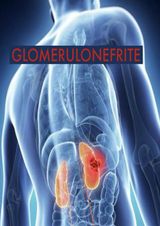 GLOMERULONEFRITE