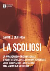 LA SCOLIOSI