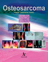 OSTEOSARCOMA