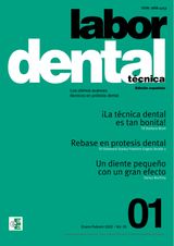 LABOR DENTAL TCNICA N1 VOL.25