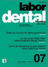 LABOR DENTAL TCNICA N7 VOL.25