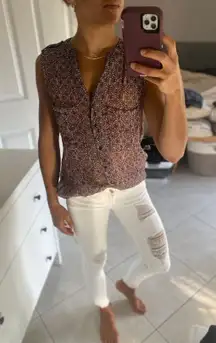 Button Up Top