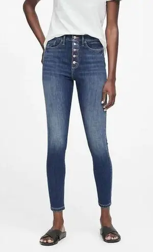 Banana Republic ✨High-Rise Skinny Button Fly Jeans✨