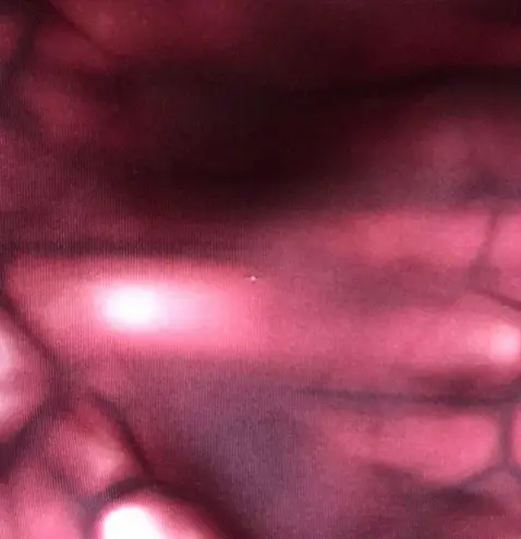 Adidas cropped  leggings