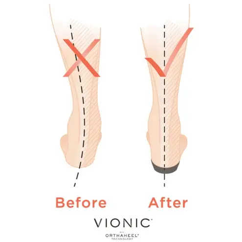 Vionic Black Suede Mary Jane Shoes Adjustable Strap Hook & Loop Size 7