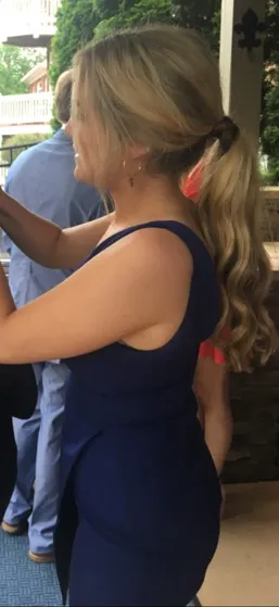 Revolve Mini Dress - Image 5