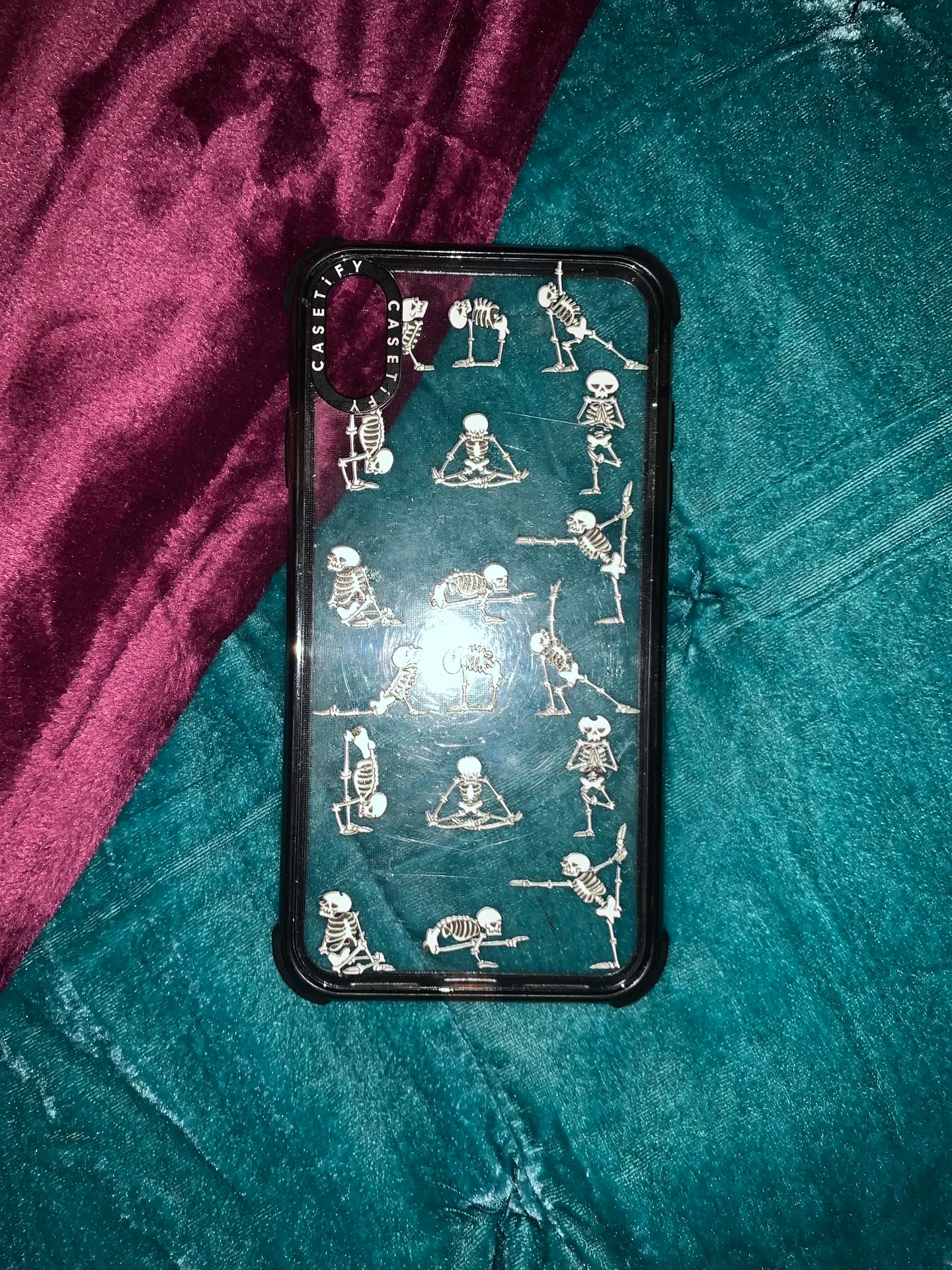 CASETiFY Skeleton Case iPhone XS Max - Image 2