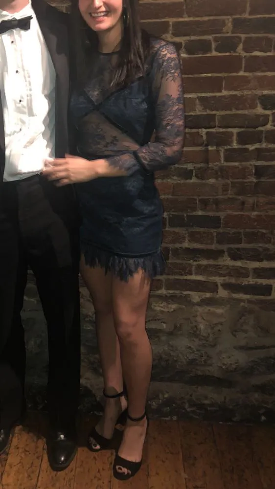 Lovers + Friends Dress - Image 4