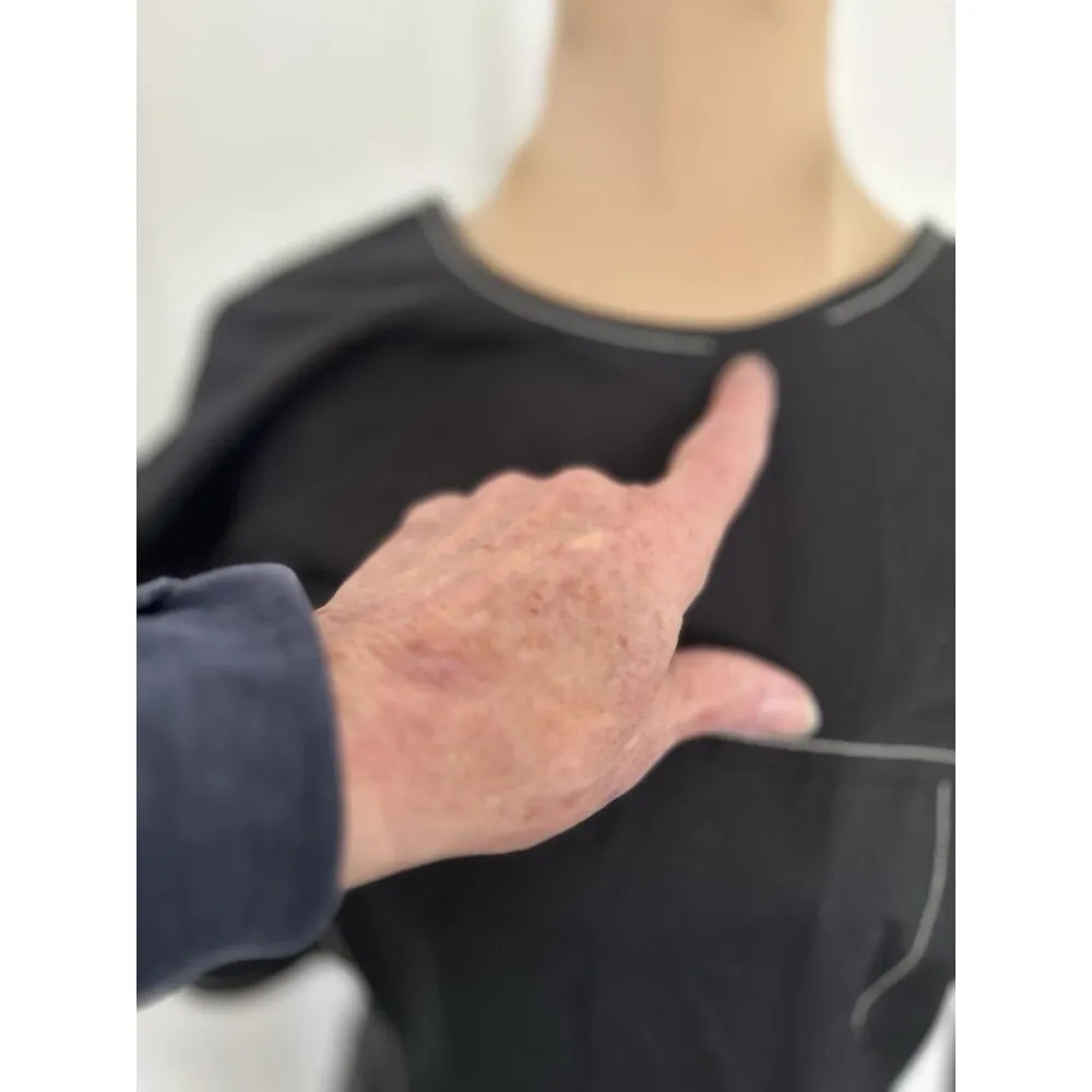 Madewell Jinni Dress Short Puff Sleeve Drop Waist Top Stitching Midi Black Sz 2 - Image 5