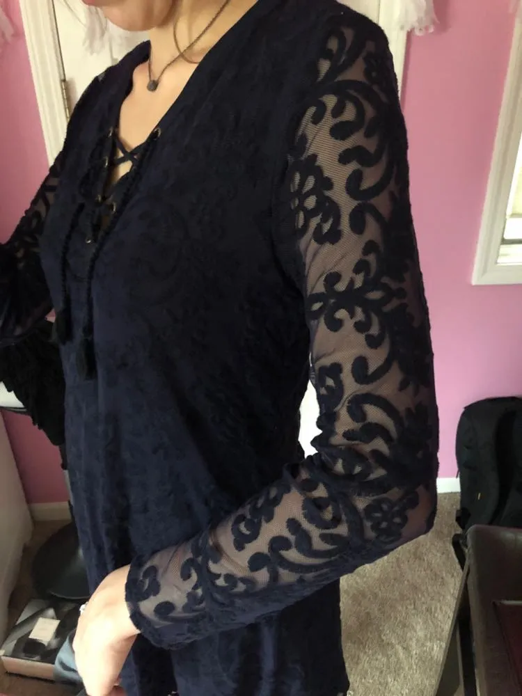 Lace dress  - Image 3