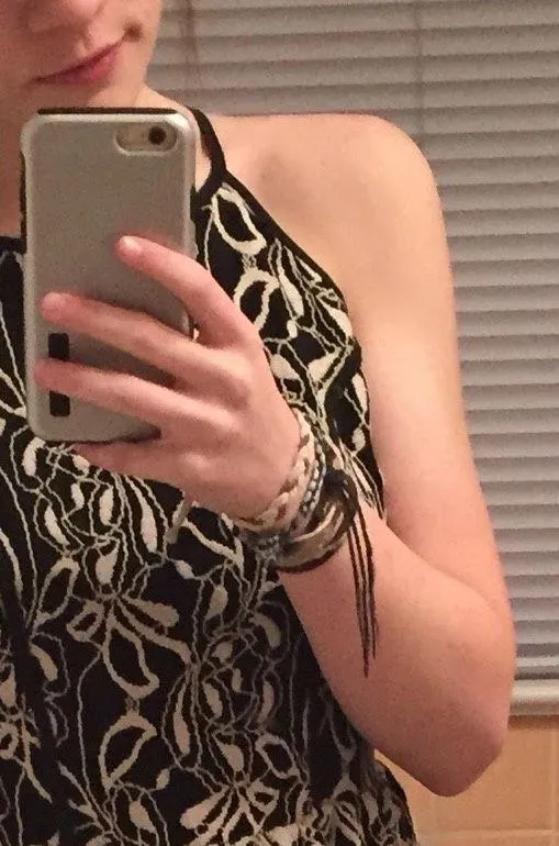 Black and White Lace Dress - Image 4