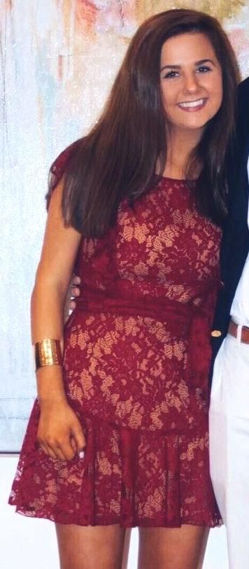 open back mini dress