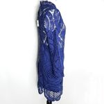 CHOiES New  Blue Lace Dress Medium Photo 4