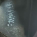 Sugar thrillz Stylish Platform Lace Photo 3