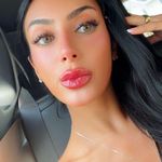 Aerie  shorts Photo 6