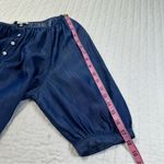 On 34th Women's Elbow Photo 7