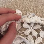 Hollister  Lace Floral Zip Up Dress Photo 3