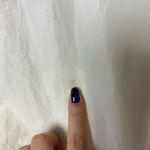 Brandy Melville Jennise stripe hooded windbreaker Photo 3