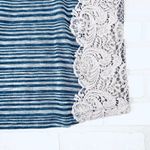 We The Free  Striped Lace Side Tunic Top Women's S/P Blue Grey Photo 4