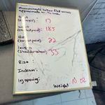 Parker Newton Blue White Stripe Scalloped Embroidered Eyelet Dress Size XS Photo 13