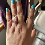 Gold Baroque Freshwater pearl ring Multiple Photo 5