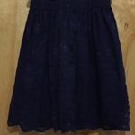 Little Navy Blue Lace Dress Photo 2