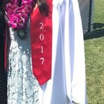 Hollister Lace Dress Photo 2