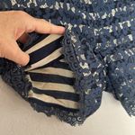 Cartonnier Blue Lace Shorts Side Zip Pockets Preppy Boho Spring Vacation Photo 3