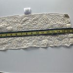 Lace Button Photo 2