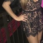 Tobi Black Lace Open-Back Romper Photo 0