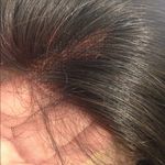 Alopecia Human hair virgin full wig Swisslace wigs Brown Photo 2