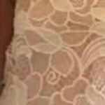 Lovers + Friends Dress Photo 2