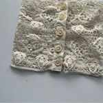 Lace Button Photo 1
