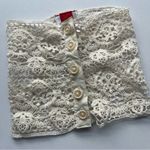 Lace Button Photo 0