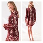 Kimchi Blue Urban Outfitters xsmall floral dress Photo 5