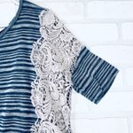 We The Free  Striped Lace Side Tunic Top Women's S/P Blue Grey Photo 13