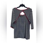 Fenn Wright Manson Black & Cream Cutout Back Striped Top. Photo 1