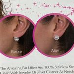 Stainless Ear lifters set Photo 6