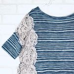 We The Free  Striped Lace Side Tunic Top Women's S/P Blue Grey Photo 7