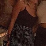 Silence + Noise Black & White Striped Shorts Photo 3