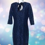 Stretch Lace Body Photo 2