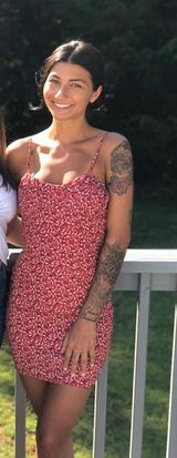 Hello Molly Summer Tight Dress Photo 0