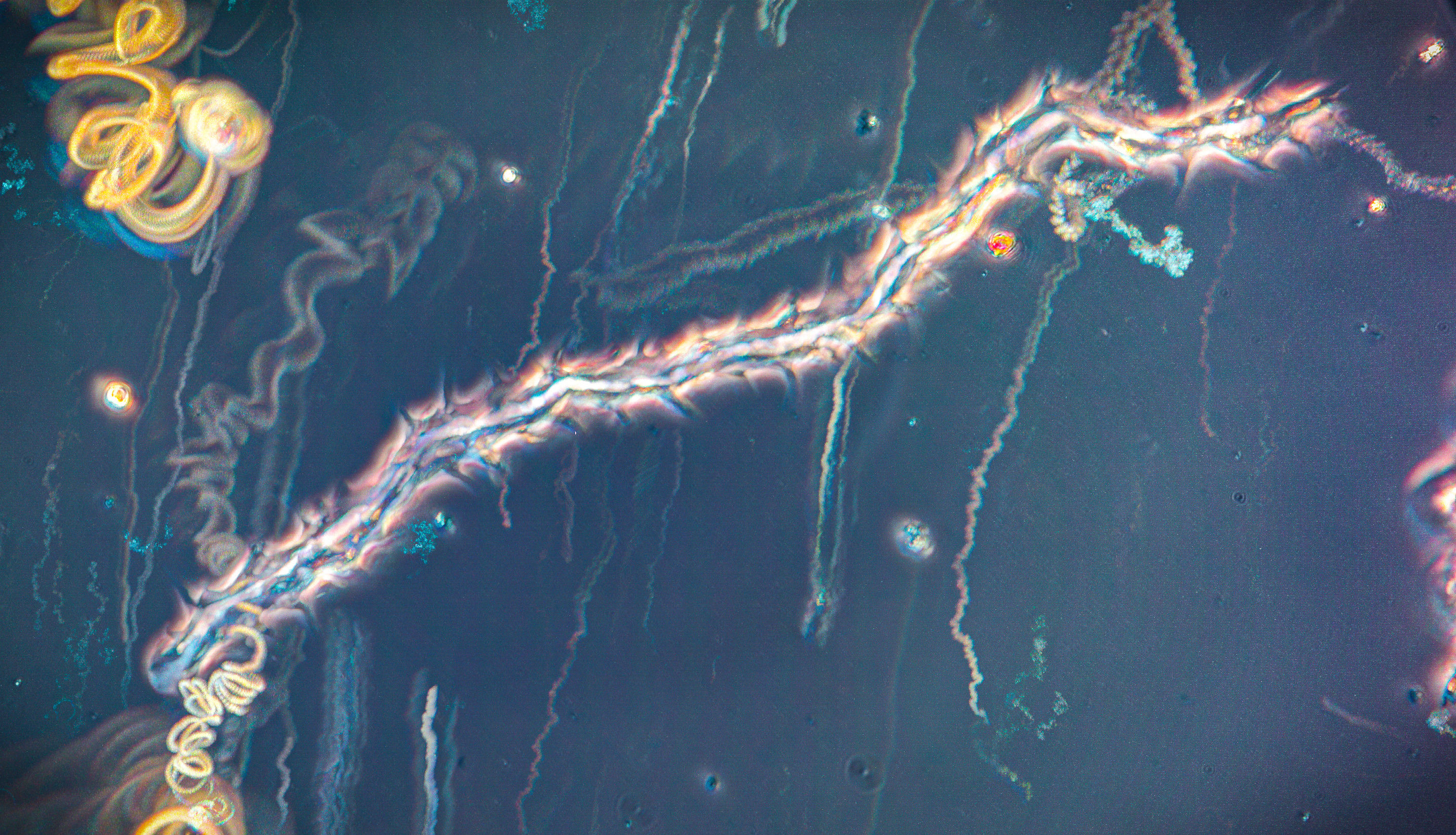 Amoeba trails1