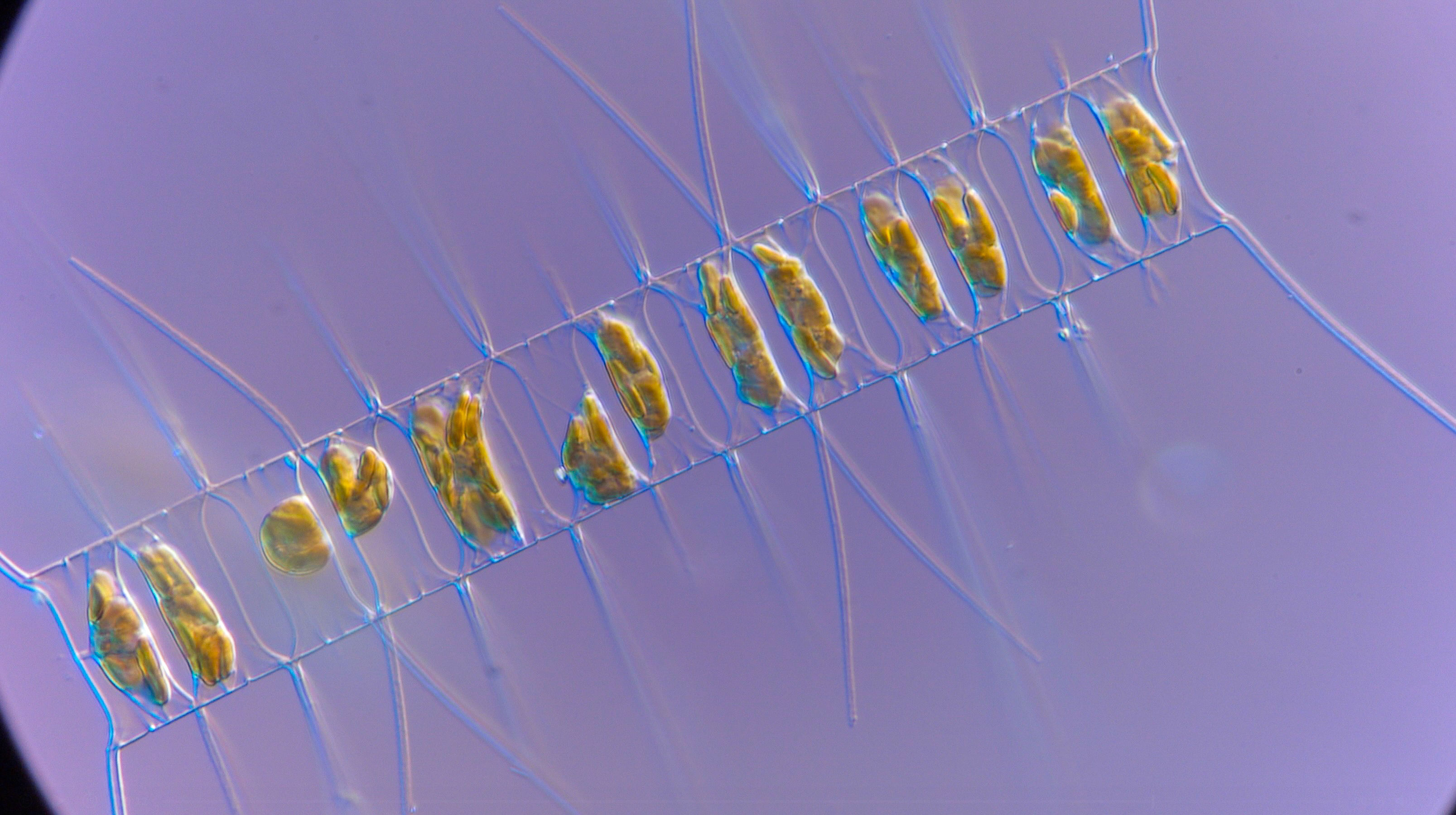 Chaetocerus (diatom)