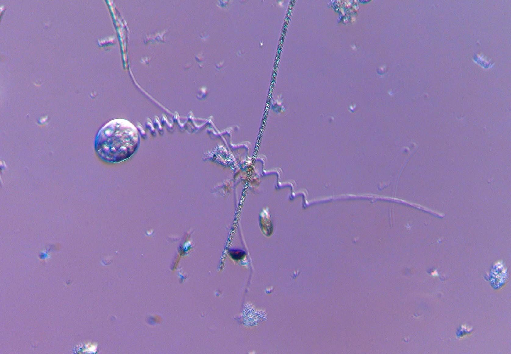 Vorticella slow motion Mount auburn cemetery 11/2/24