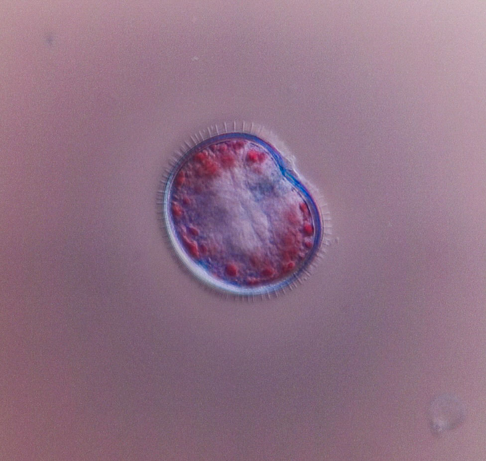 unknown dinoflagellate Boston harbor