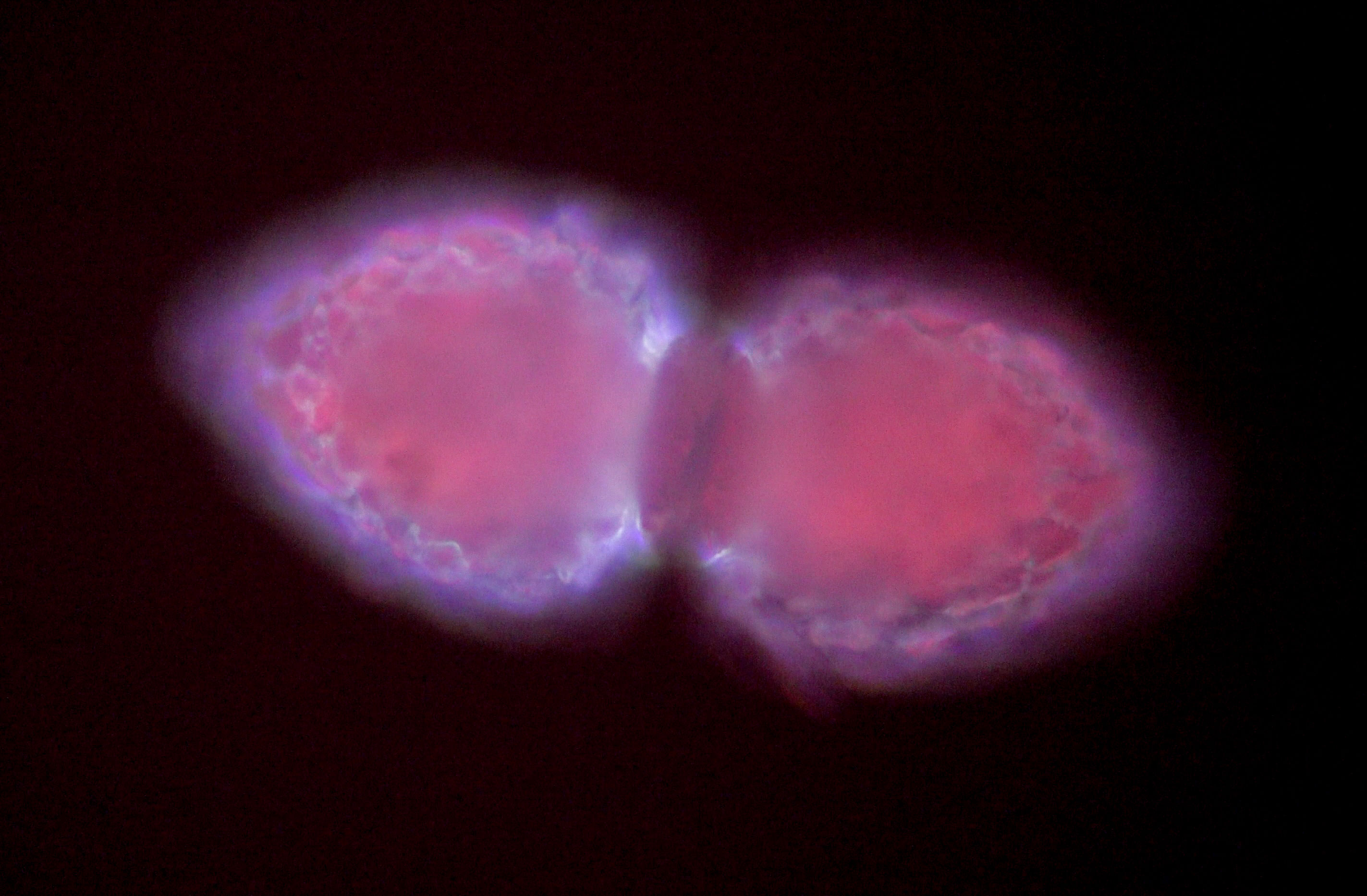 2 tintinnids pink 11-2-24