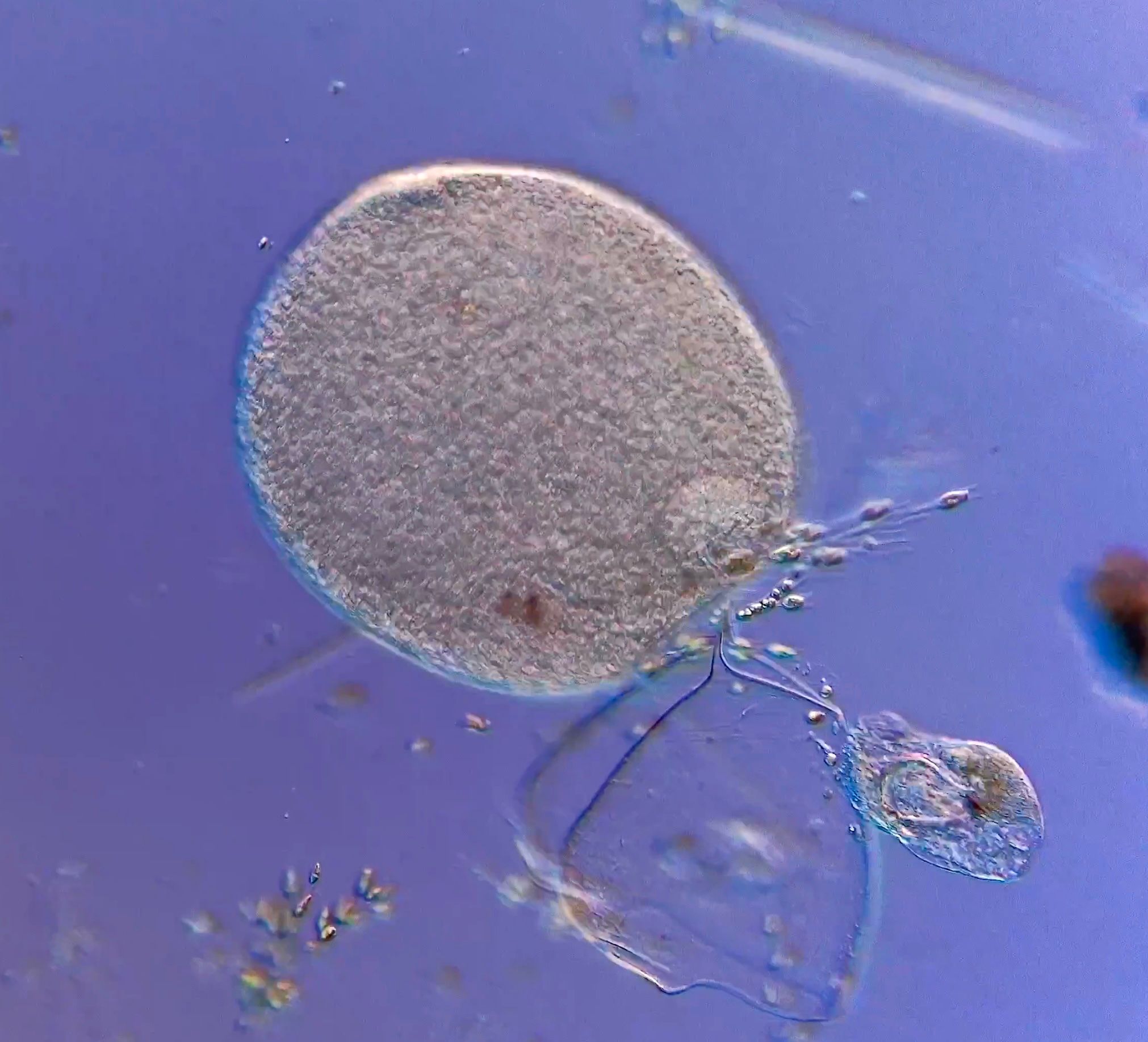 Huge ciliates from the Charles