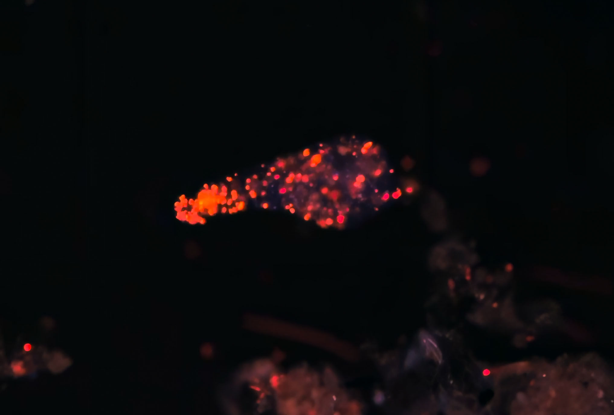 Fluorescence amoeba Chandlers Pond