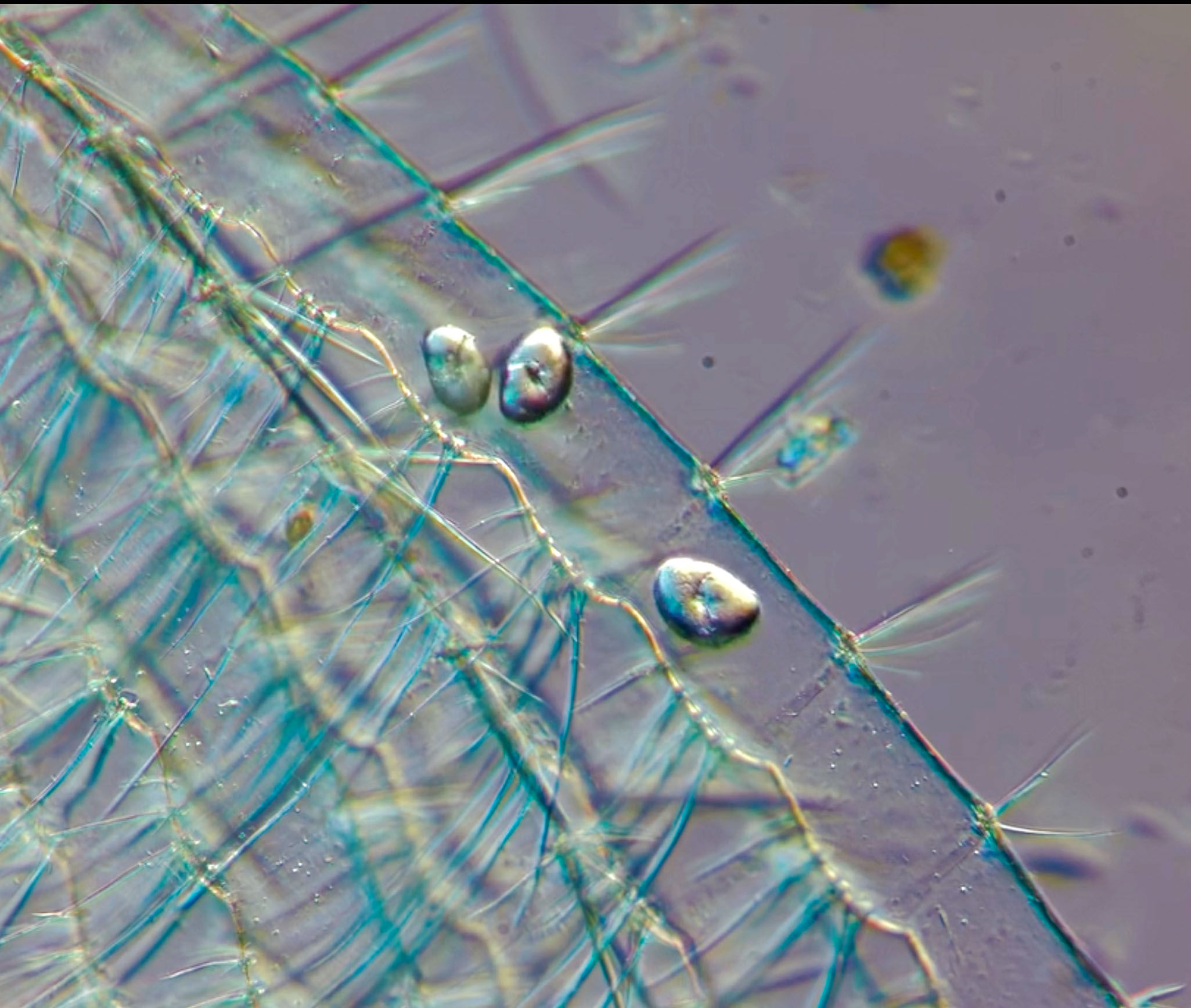 Ciliates inside copepod exoskeleton Boston harbor